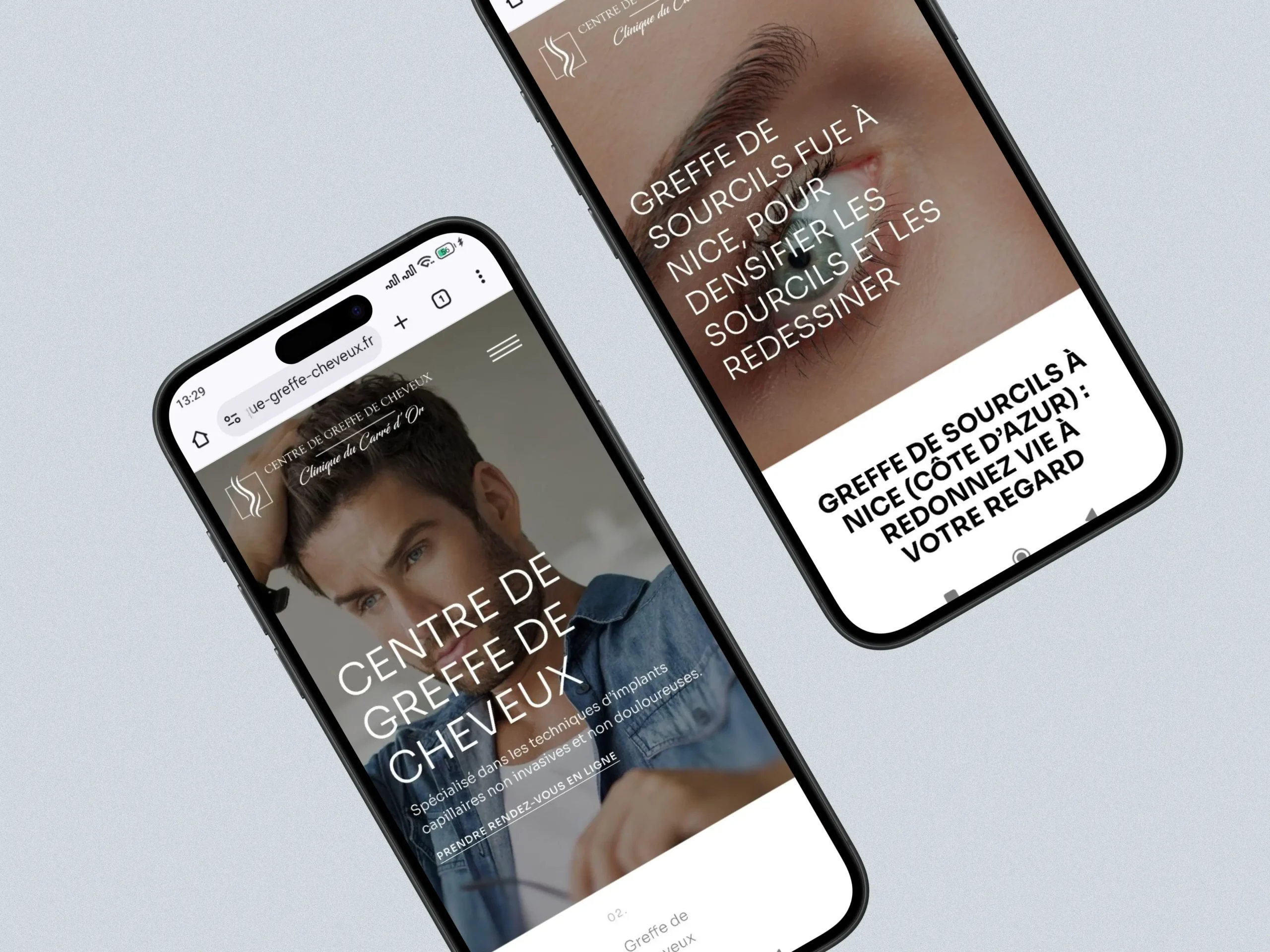 Centre de Greffe de Cheveux